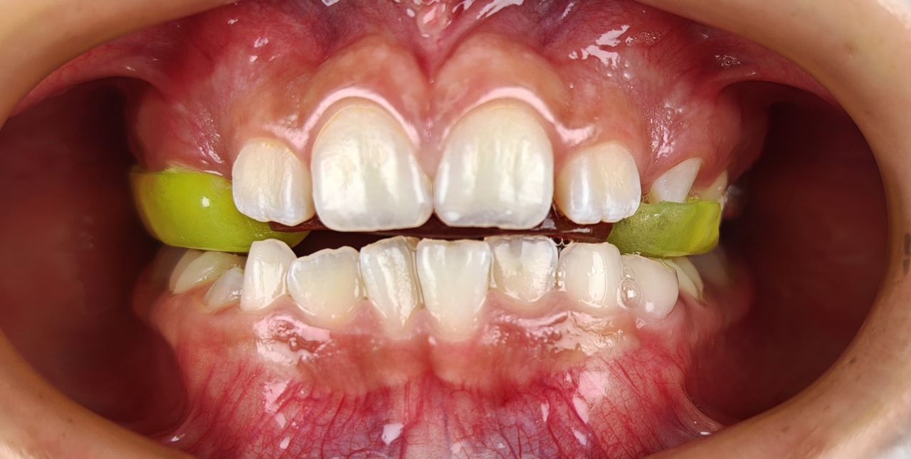 Joel Eduardo Lopez Molina-3