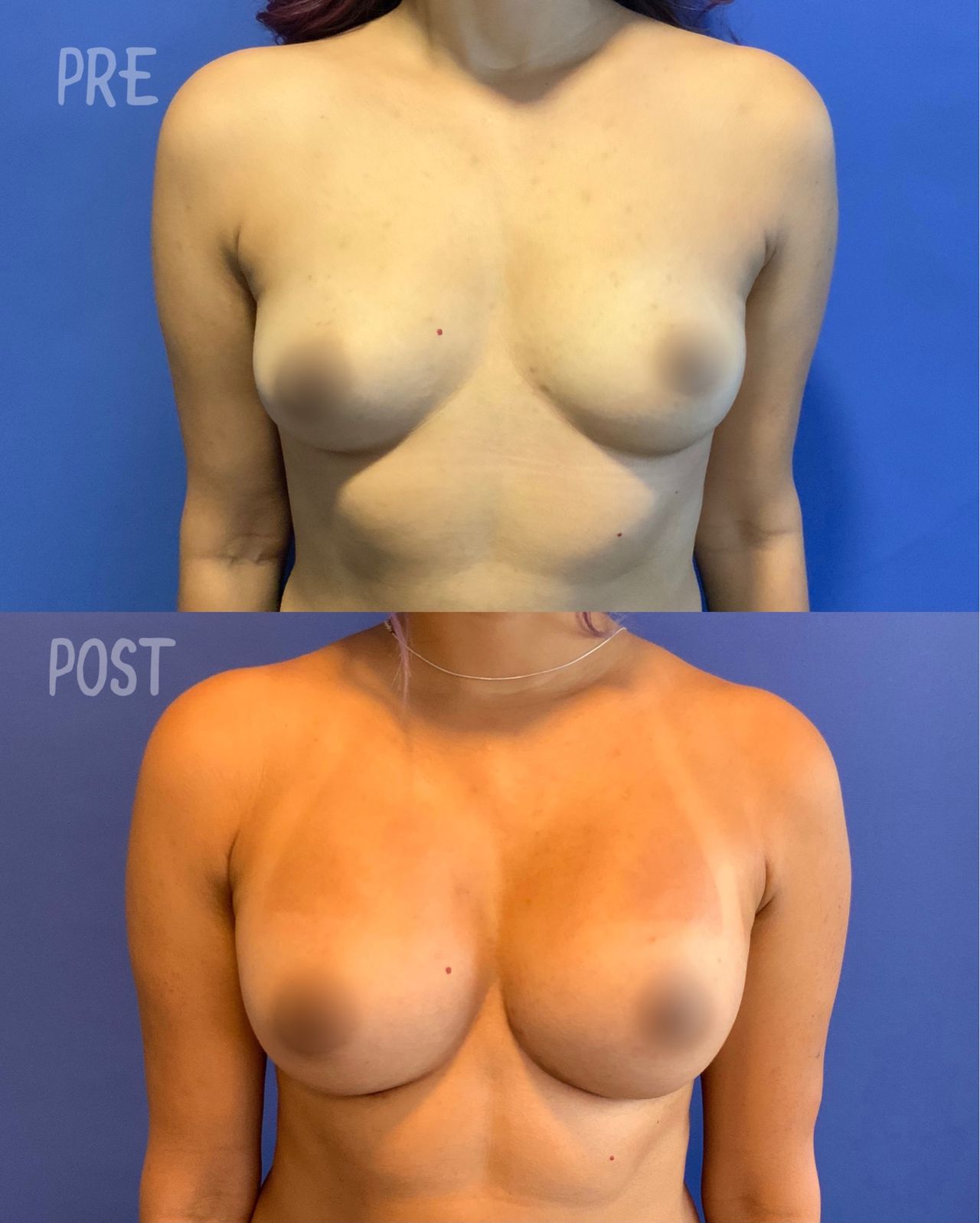 Giuseppe Tanzillo-47