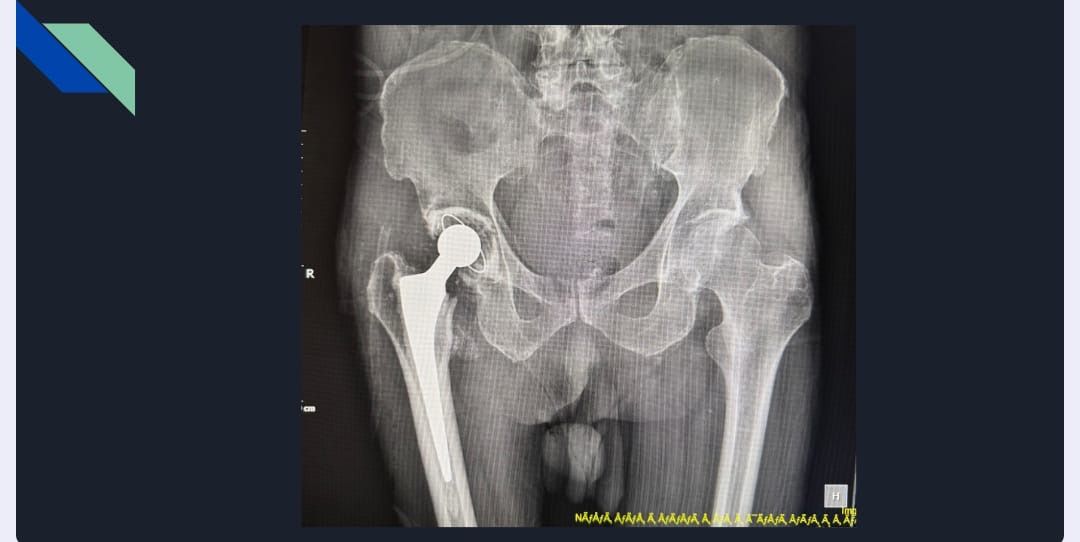 Juan Carlos Zavala Garcia-0