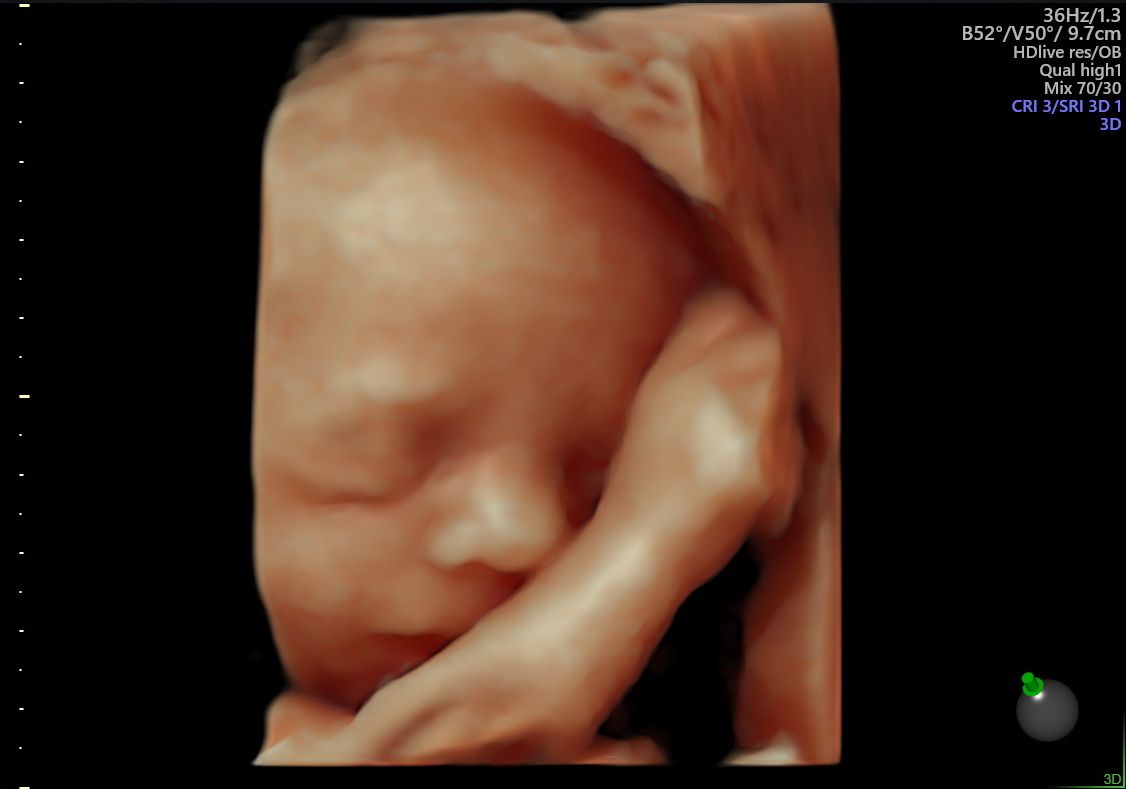 Alberto Bañuelos Peña-4