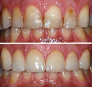 Esmeralda Candida Guerrero Pimentel-23