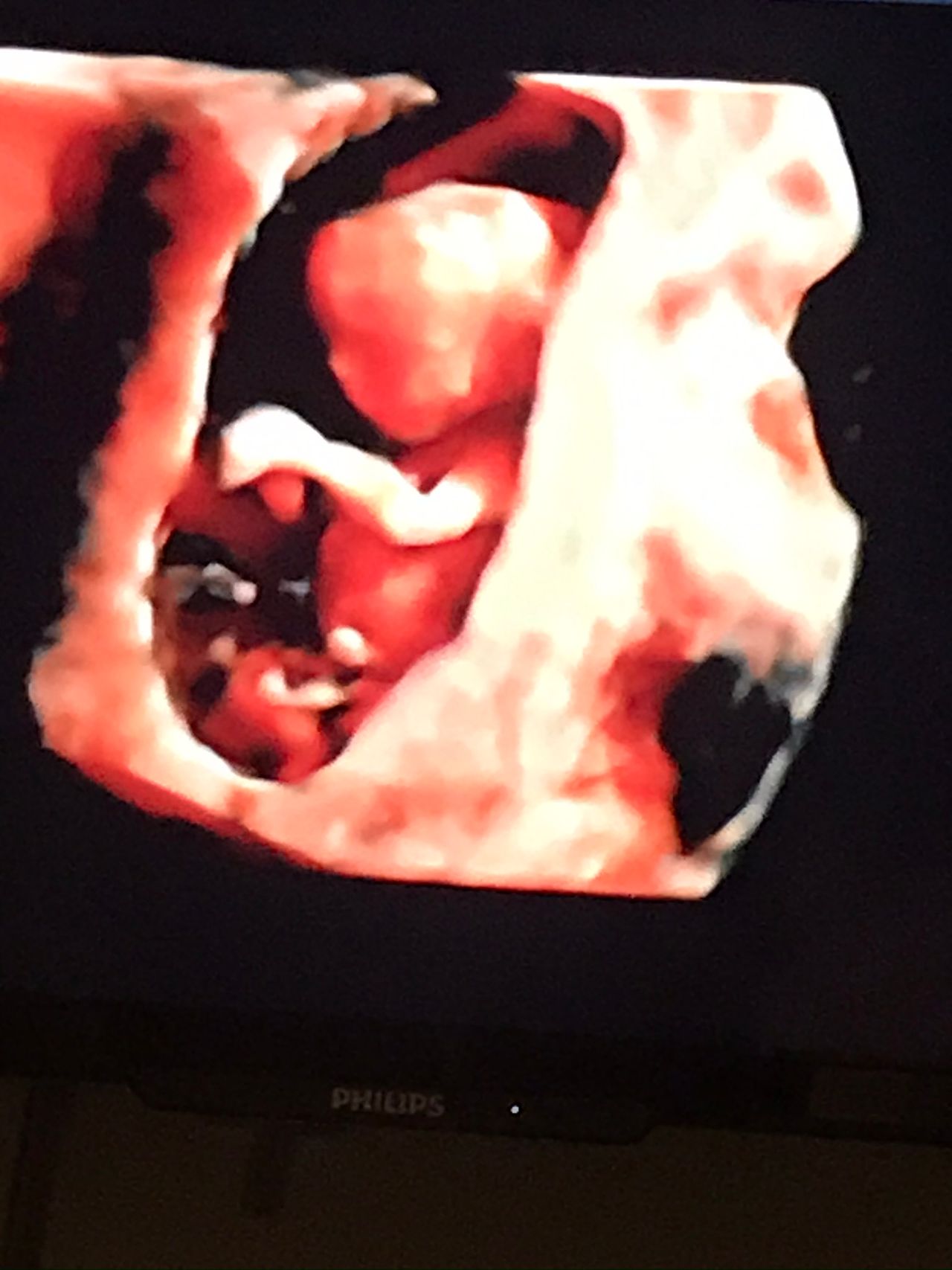 Brenda Lisset Briones Bernal-20