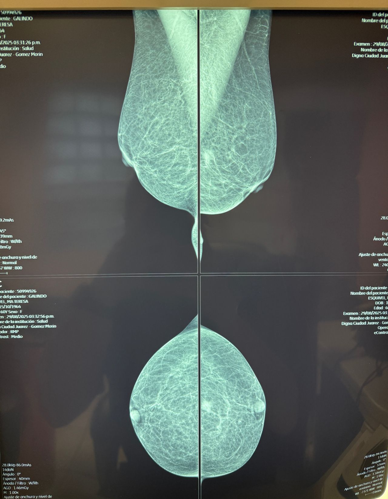 Christian Samuel Uitzil Colli-7