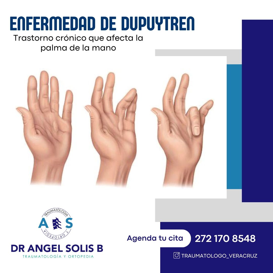 Angel Alberto Solis Barrios-4