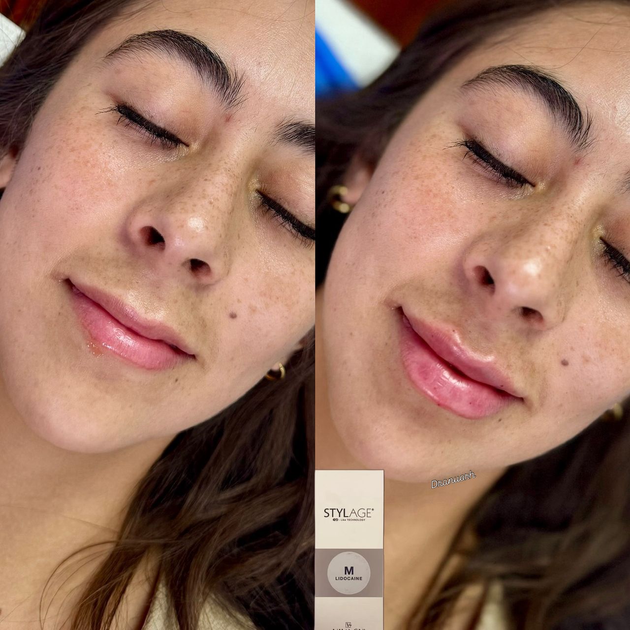 Anuar Hernández Flores-19