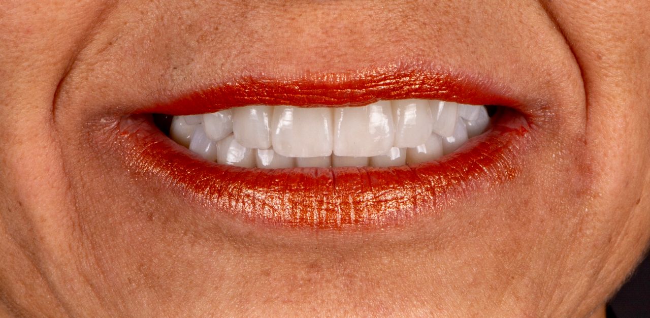 Ricardo López Lemus-59