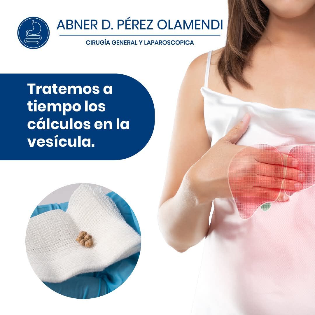 Abner Daniel Pérez Olamendi-6