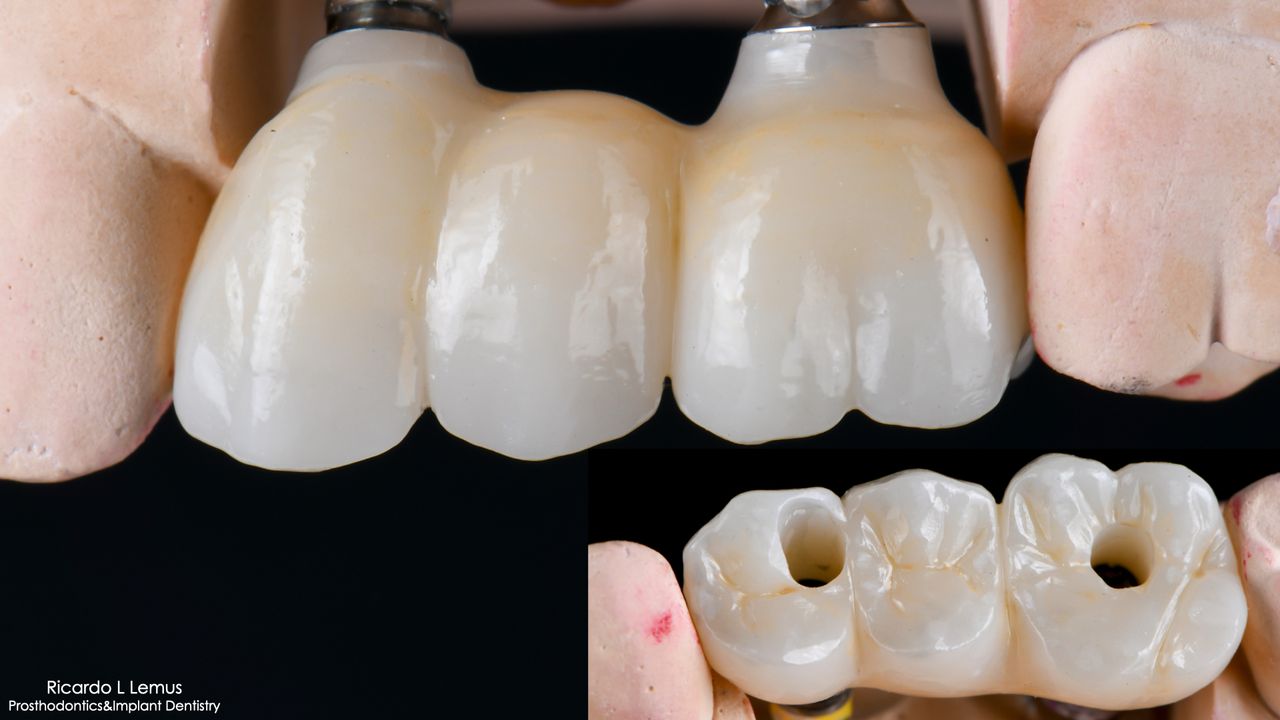 Ricardo López Lemus-107