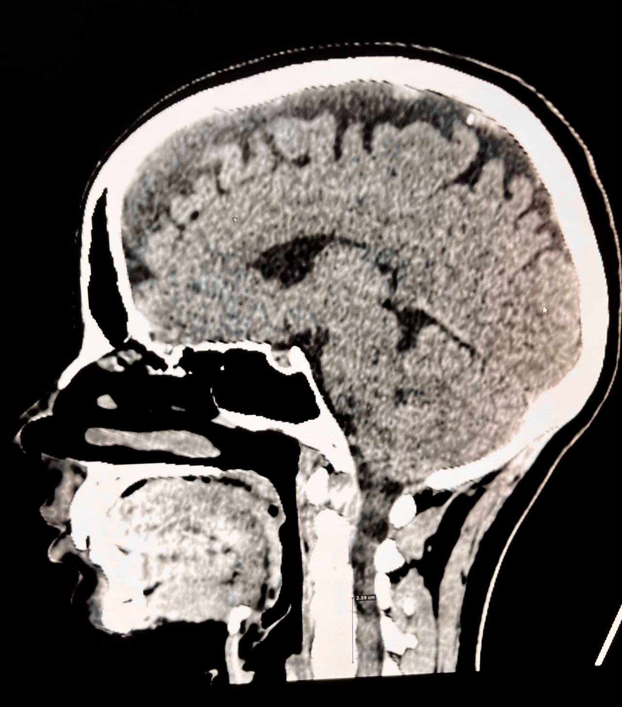 Rogelio Hernández García-48