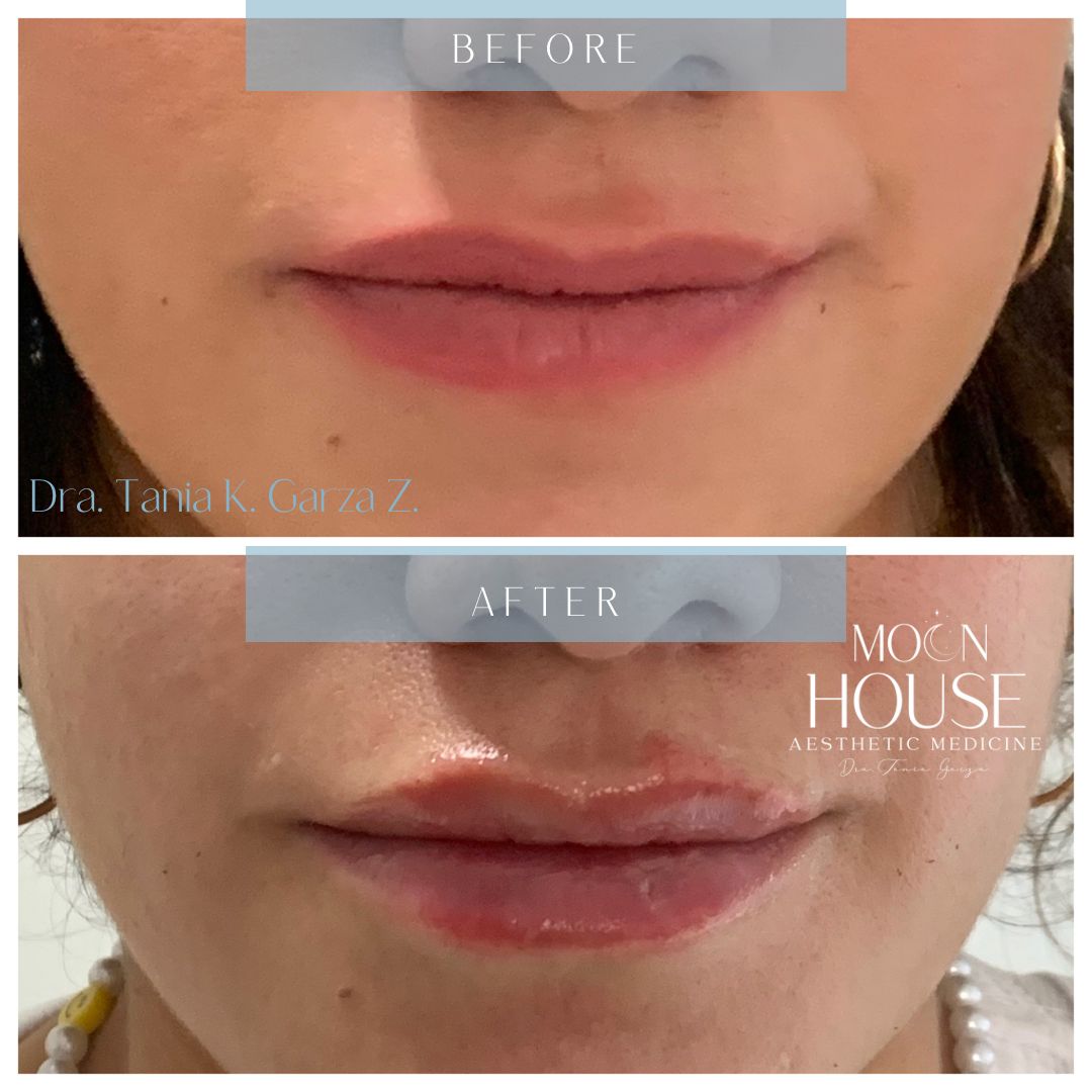 Tania Karine Garza Zepeda-14