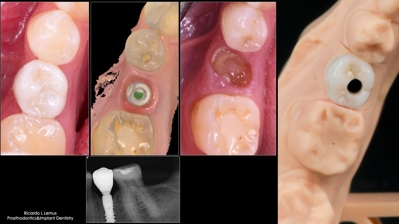 Ricardo López Lemus-126