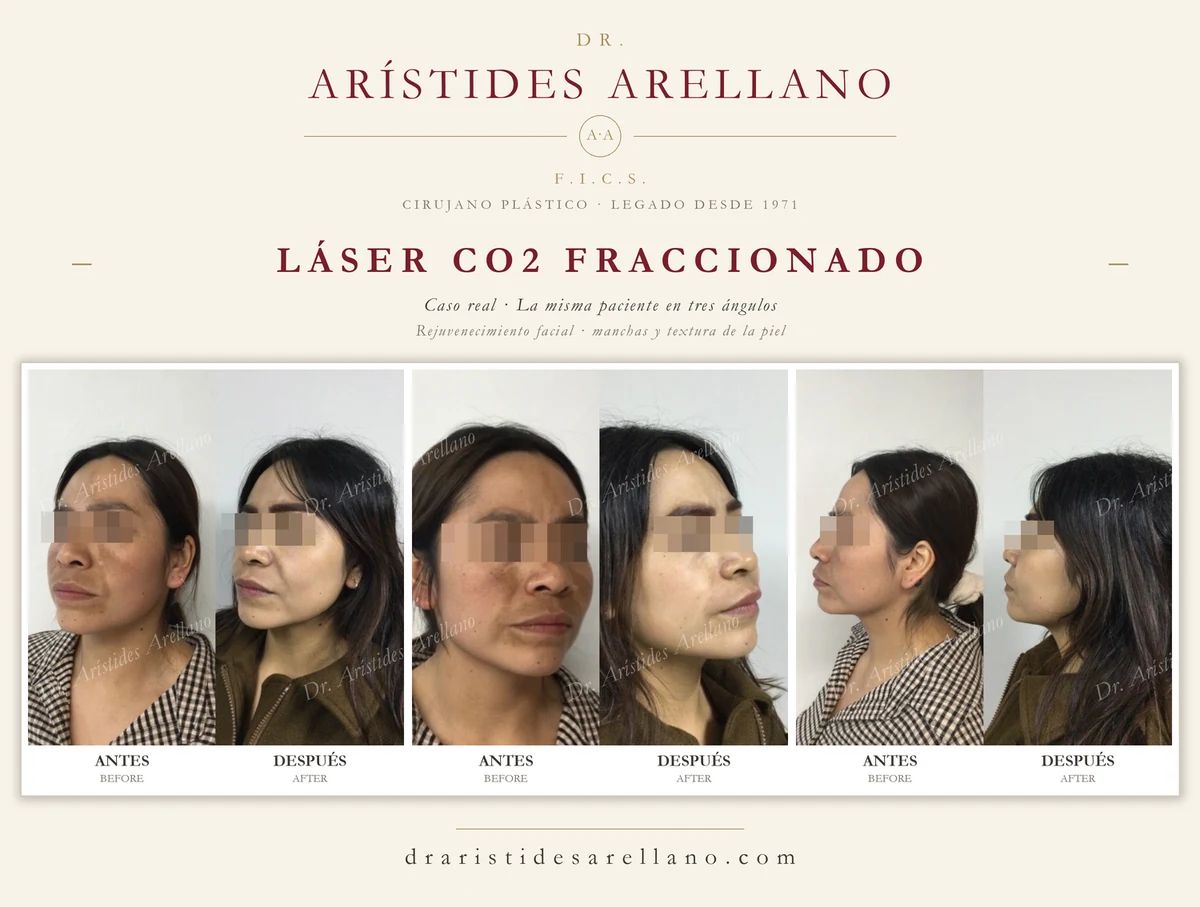Arístides Arellano Huacuja-27