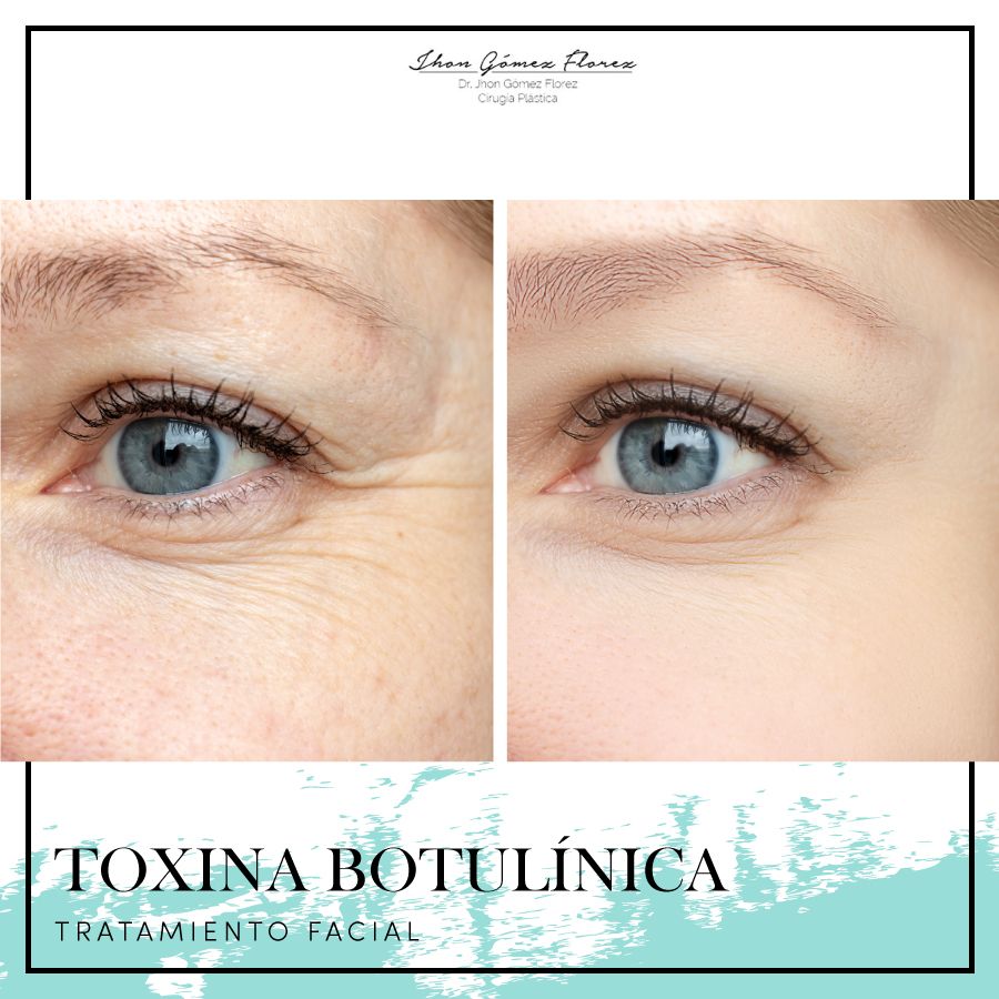 Jhon César Gómez Florez-70