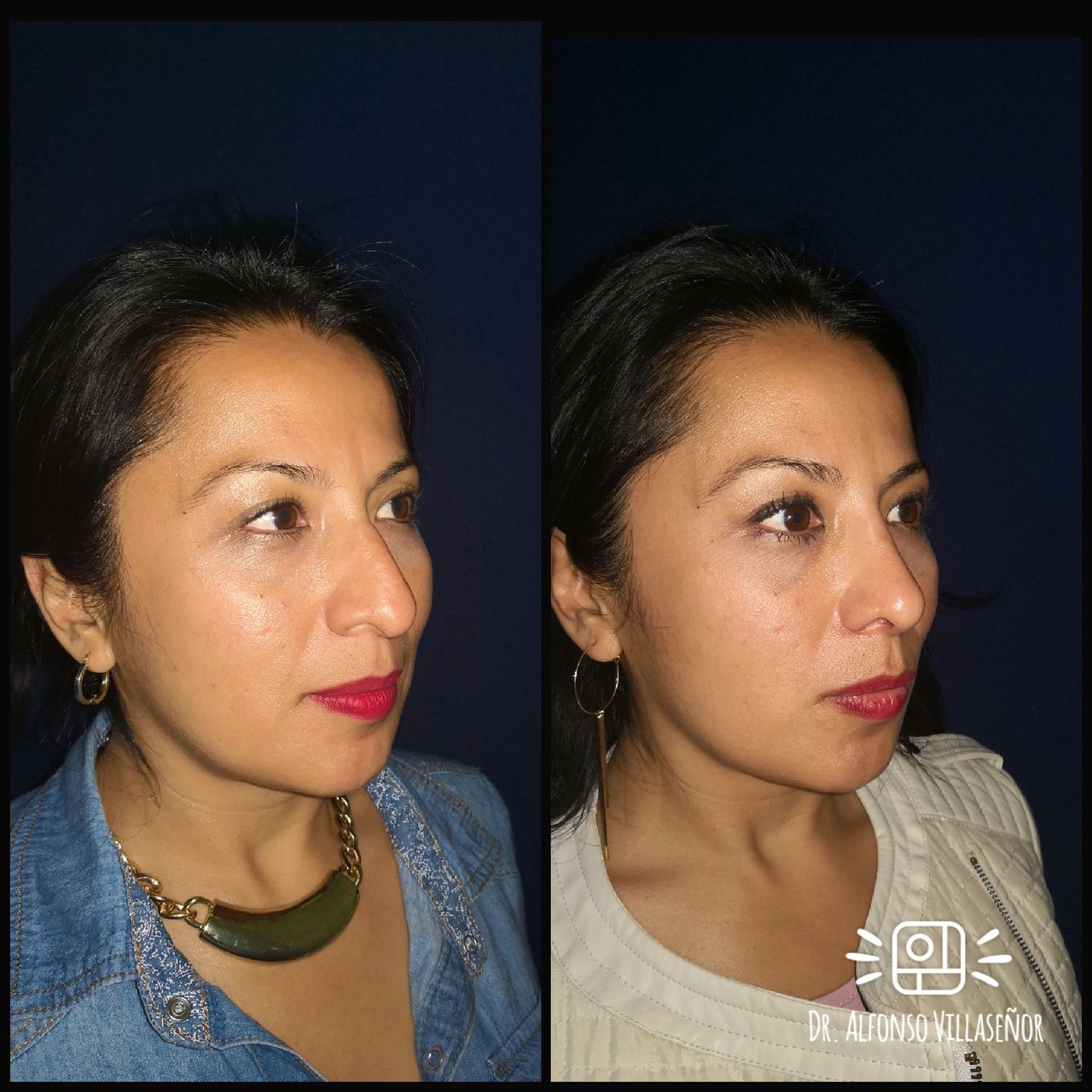 Alfonso Villaseñor Herrero-28