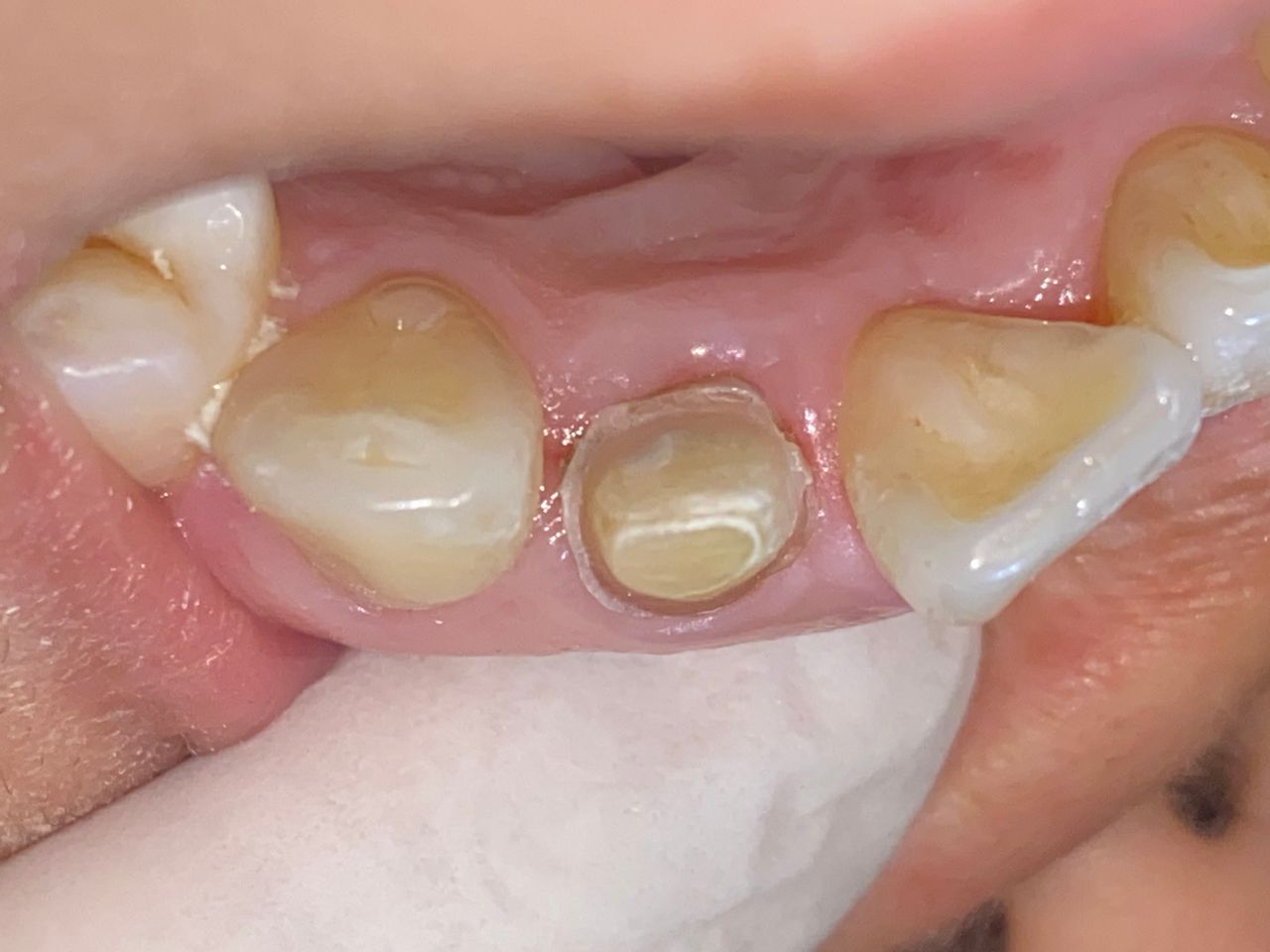 Raúl Méndez Cifuentes-6