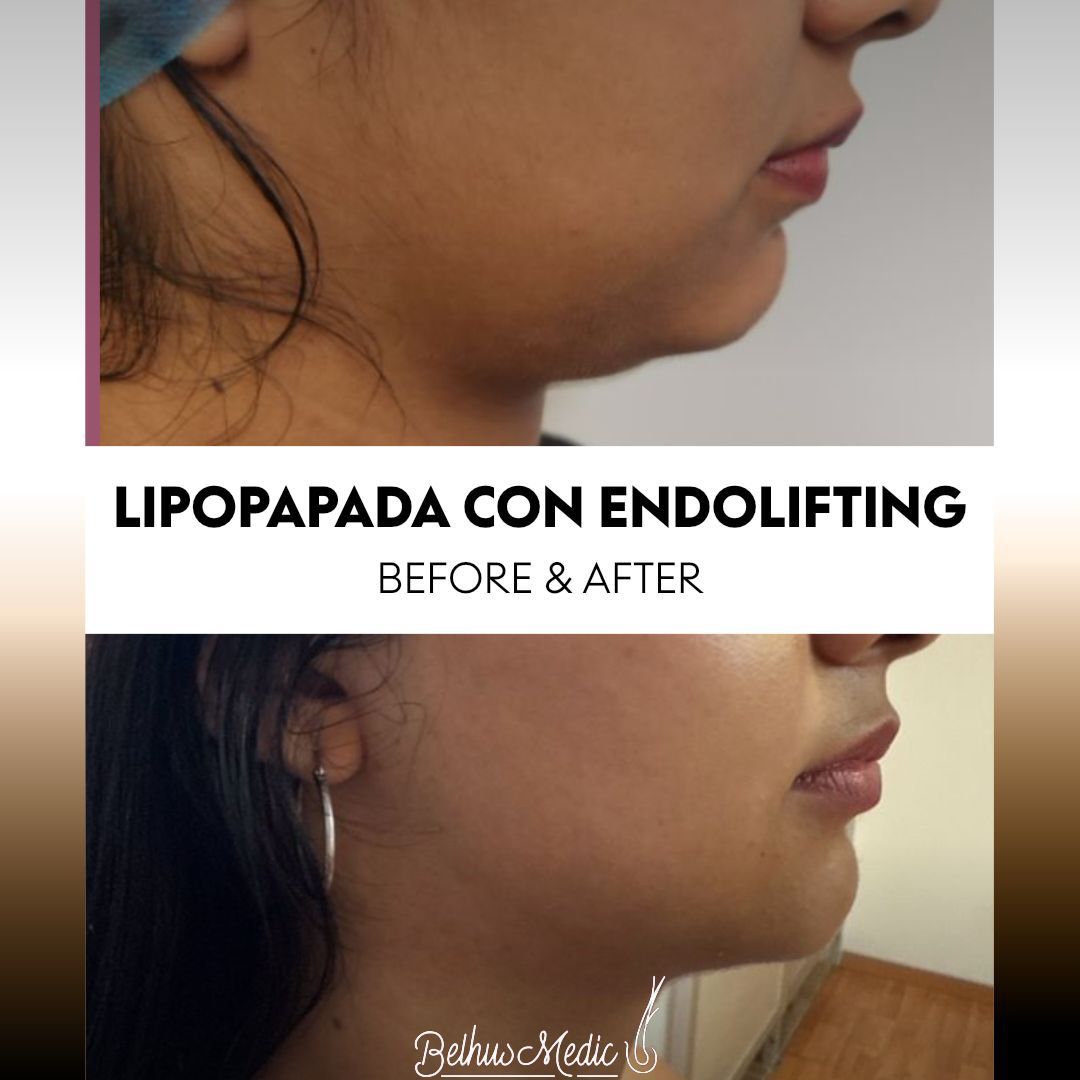 Alejandra Soriano Elorza-131