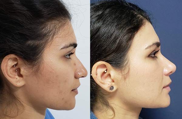 Edgar Ernesto Torres Mejía-34