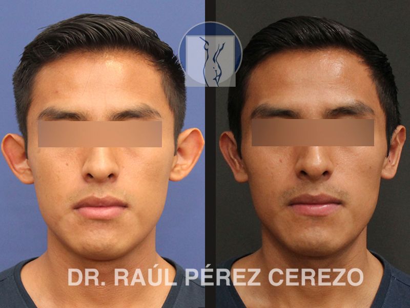 Raúl Pérez Cerezo-10