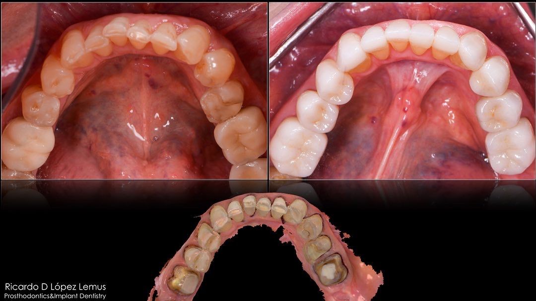 Ricardo López Lemus-26