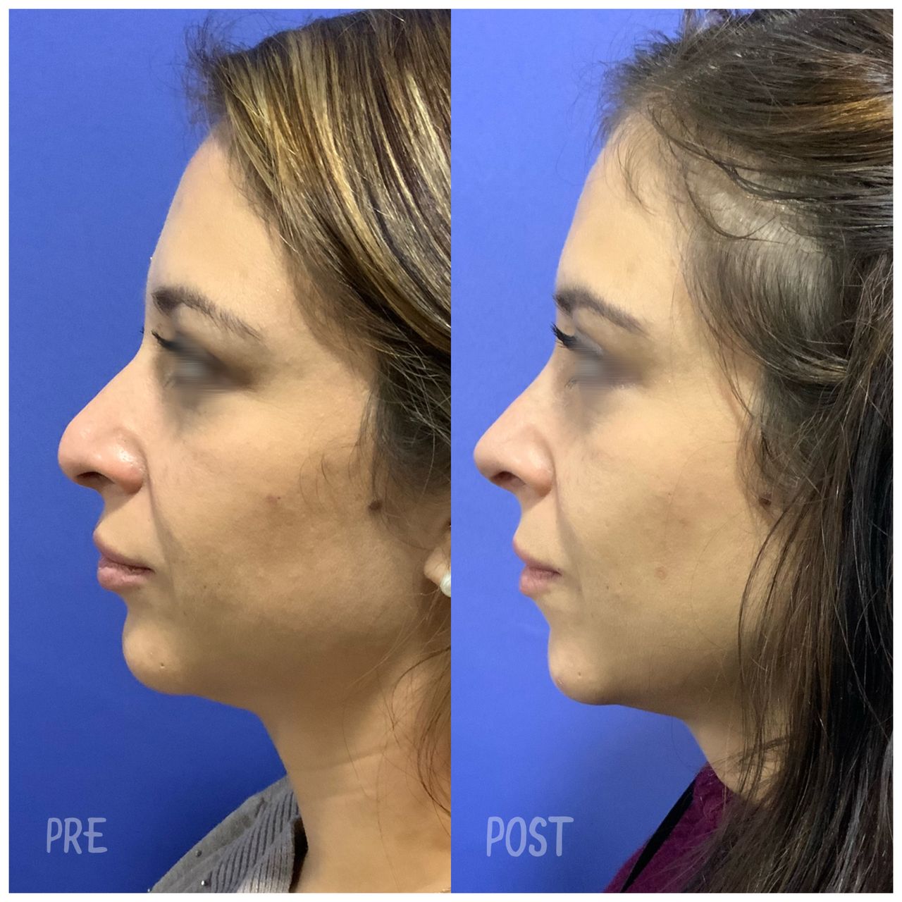 Giuseppe Tanzillo-72