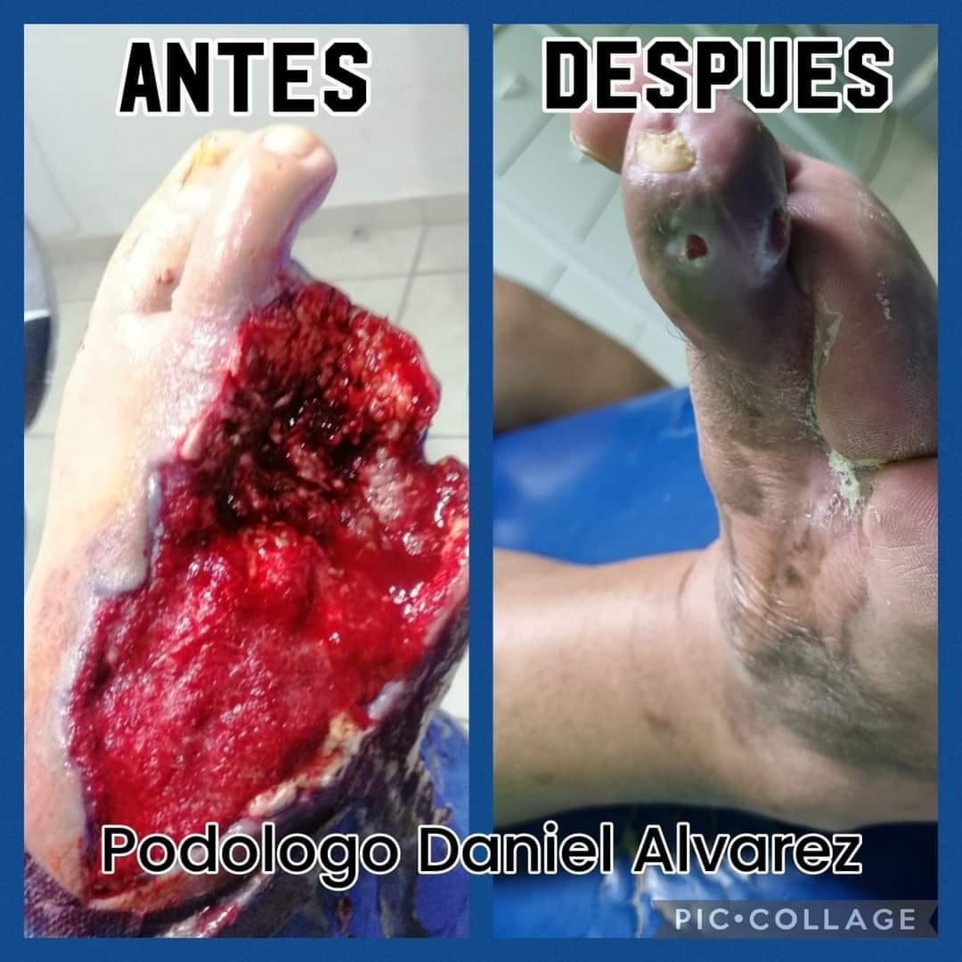 Daniel Alonso Álvarez Rivera-0