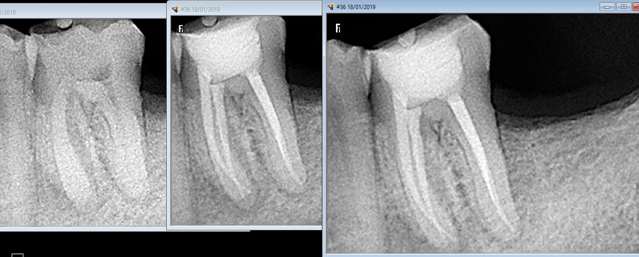 Lesli Erendira Campechano Zaragoza-13