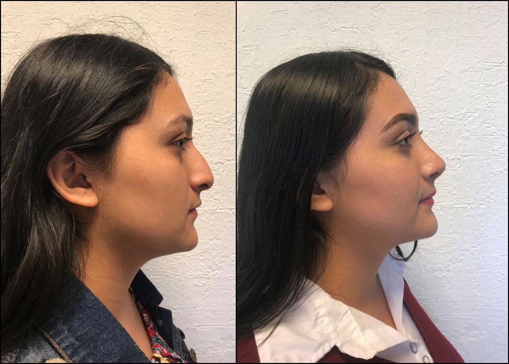 Elsa Elena Byerly Rosas-3