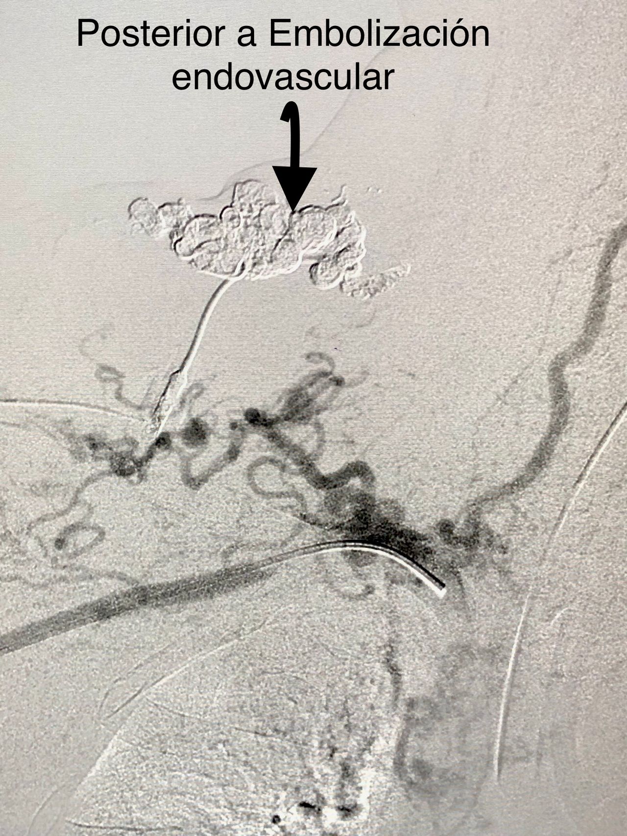 Miguel Abraham Lara Perez-17
