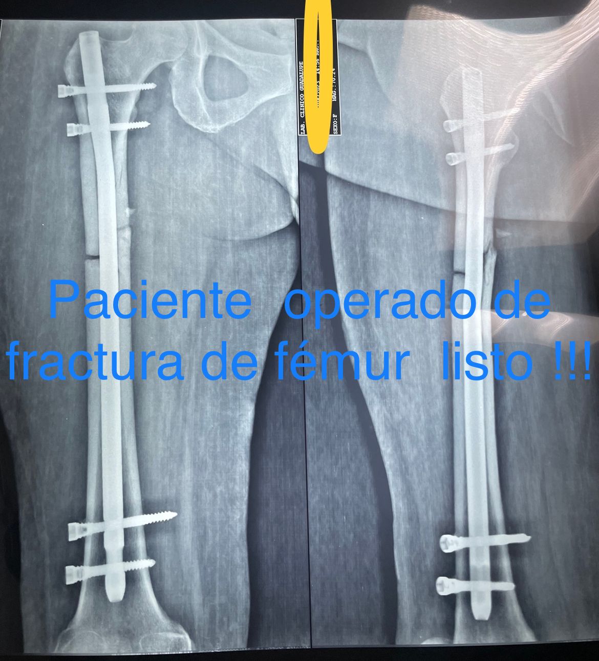 Emmanuel Bolaños Cortes-32