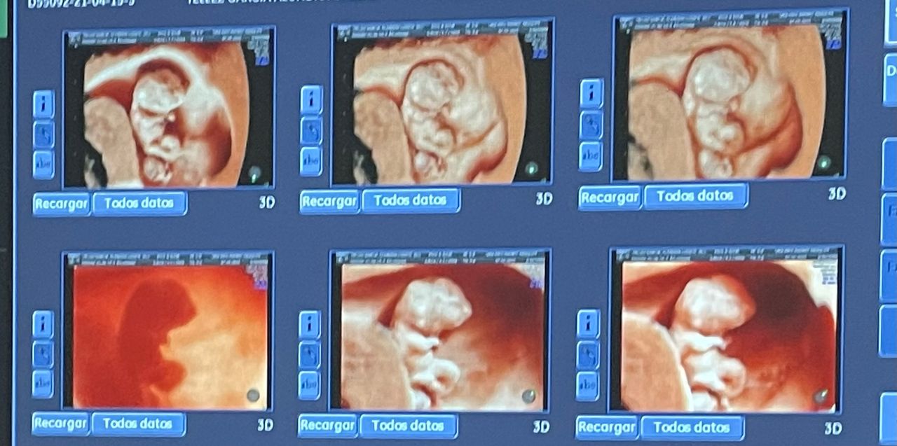 Mayi Mayret Mesquiti-18