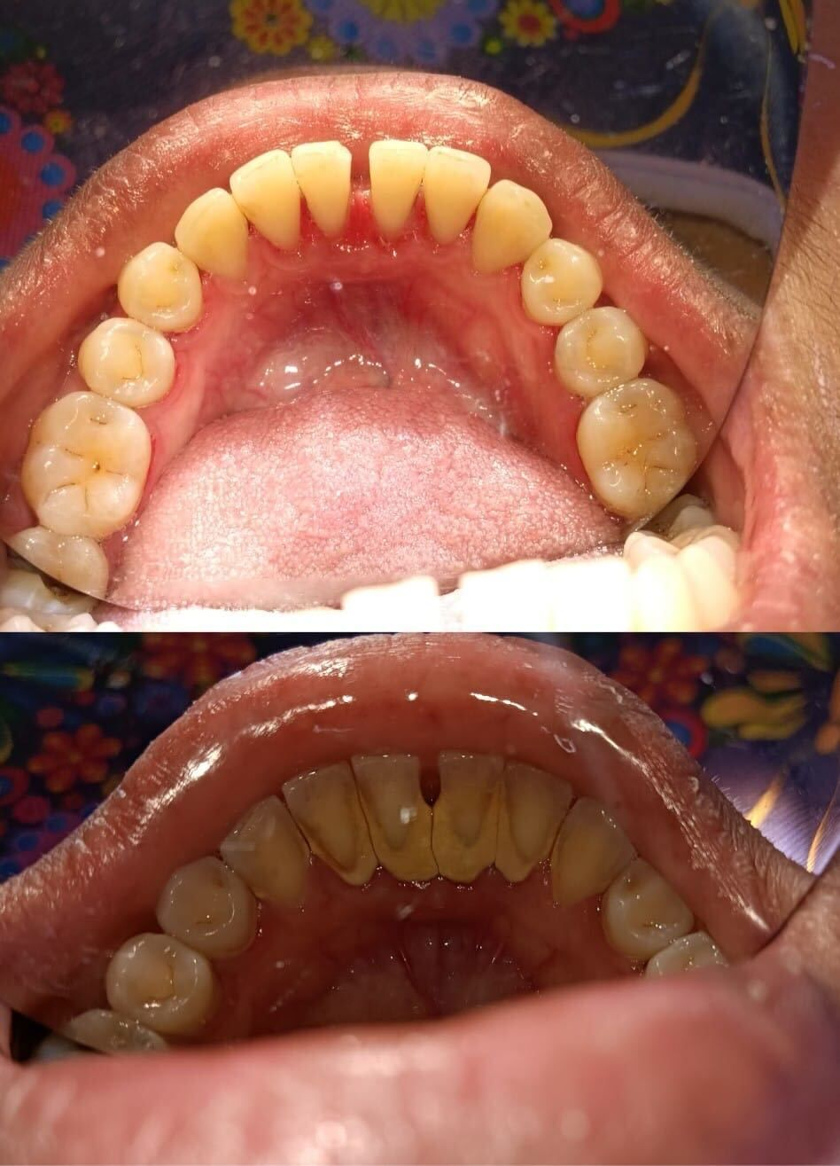 Luz Anel Valente Lozano-3