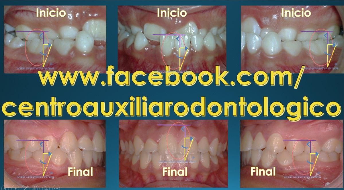 César Augusto Pérez Córdova-45