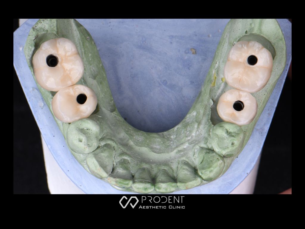 Ramiro Ivan Pérez Murillo-44