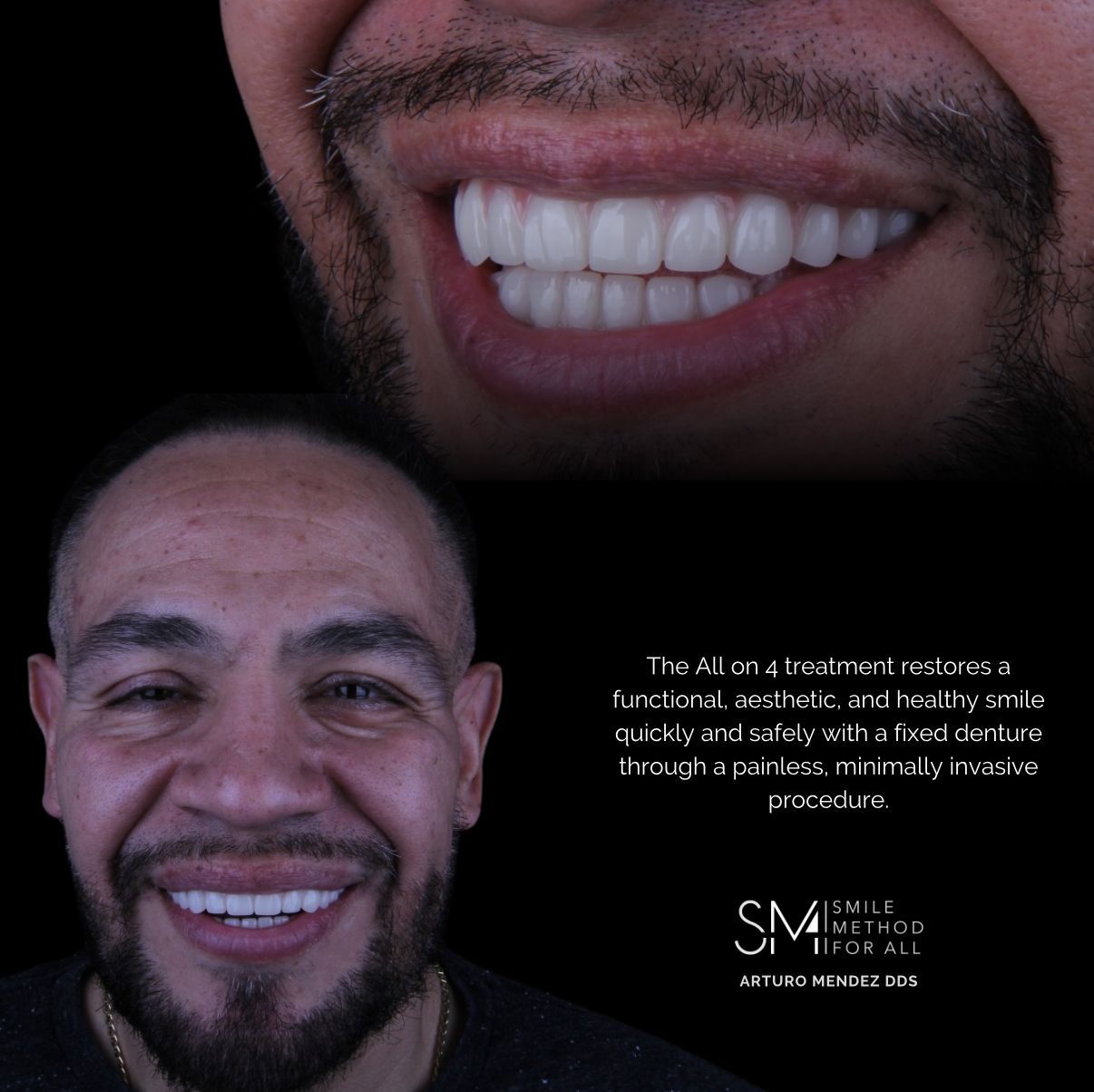 Arturo Mendez Valencia-17