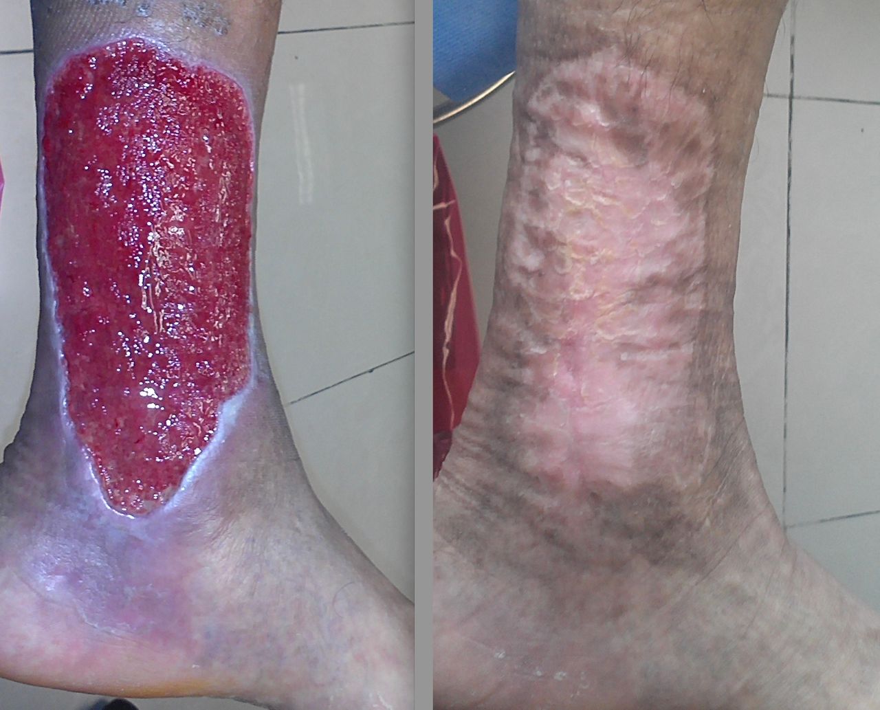 Hugo Romero Arenas-0