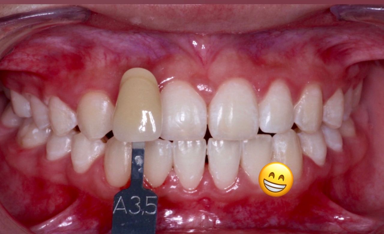 Josué Márquez Gómez-142