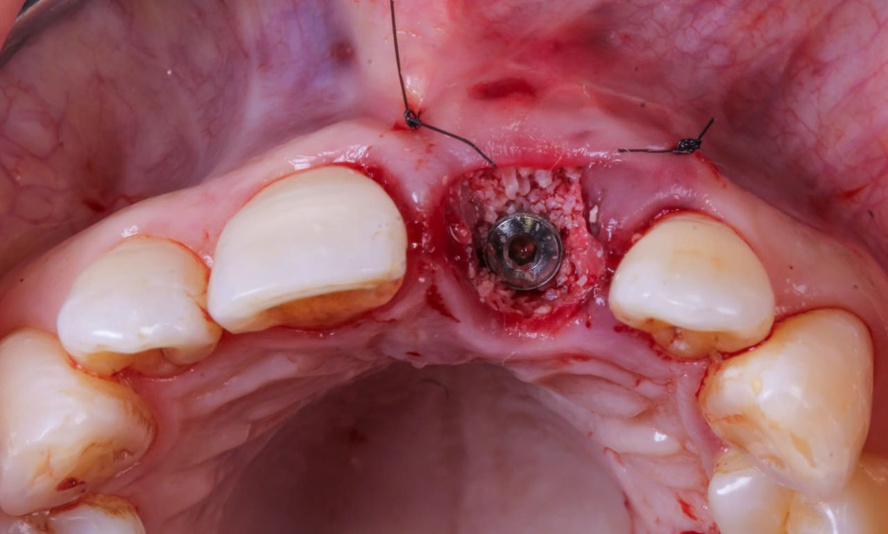 Hugo Enrique Aguilar Lamas-9