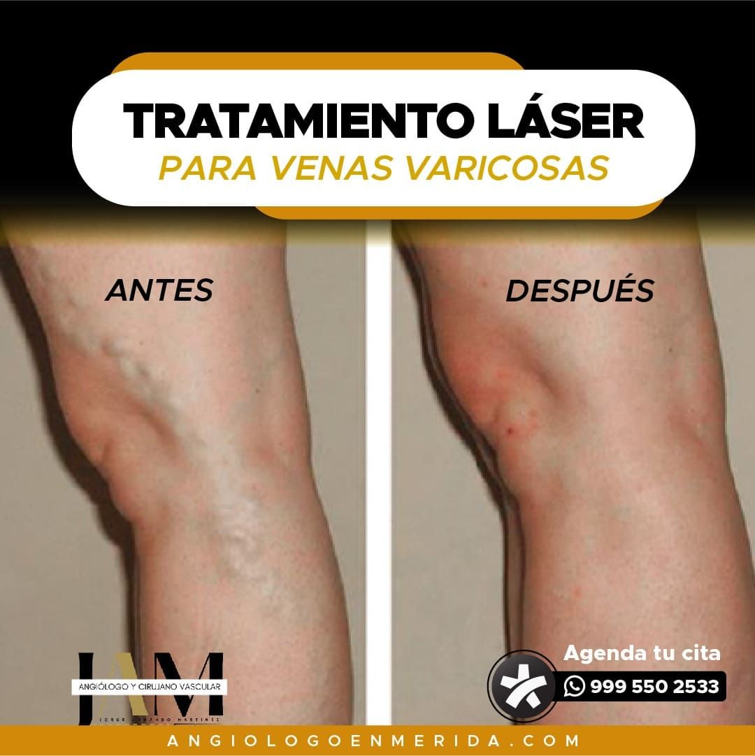 Jorge Armando Martínez Martínez-3