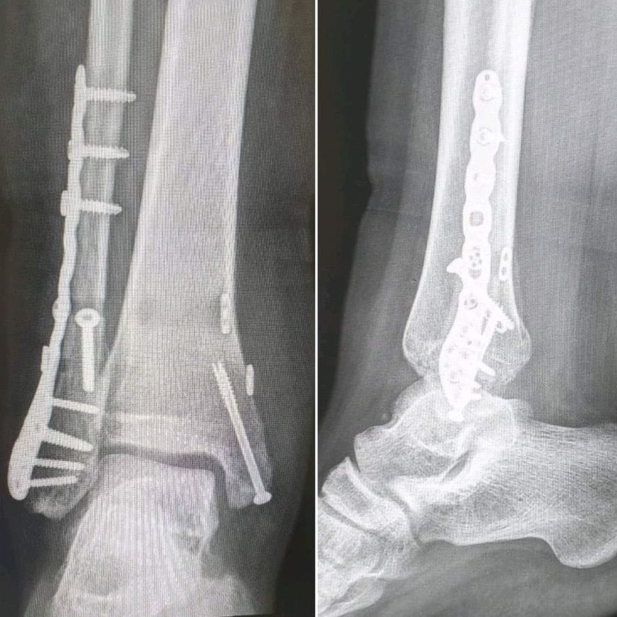 Kaori Honda Partida-7