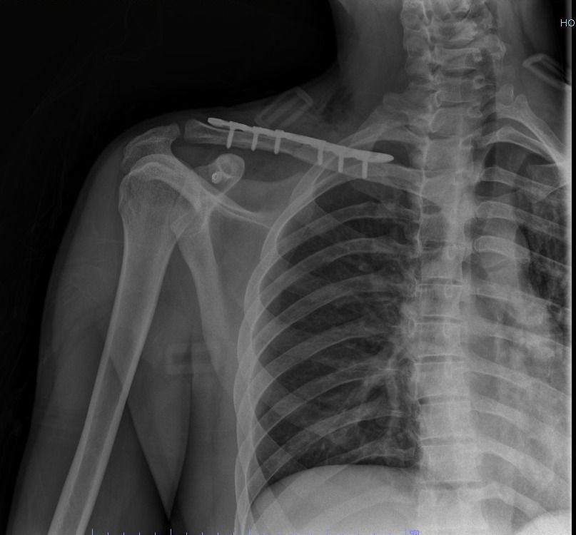 Manuel De Jesús Ambrosio Vicente-10