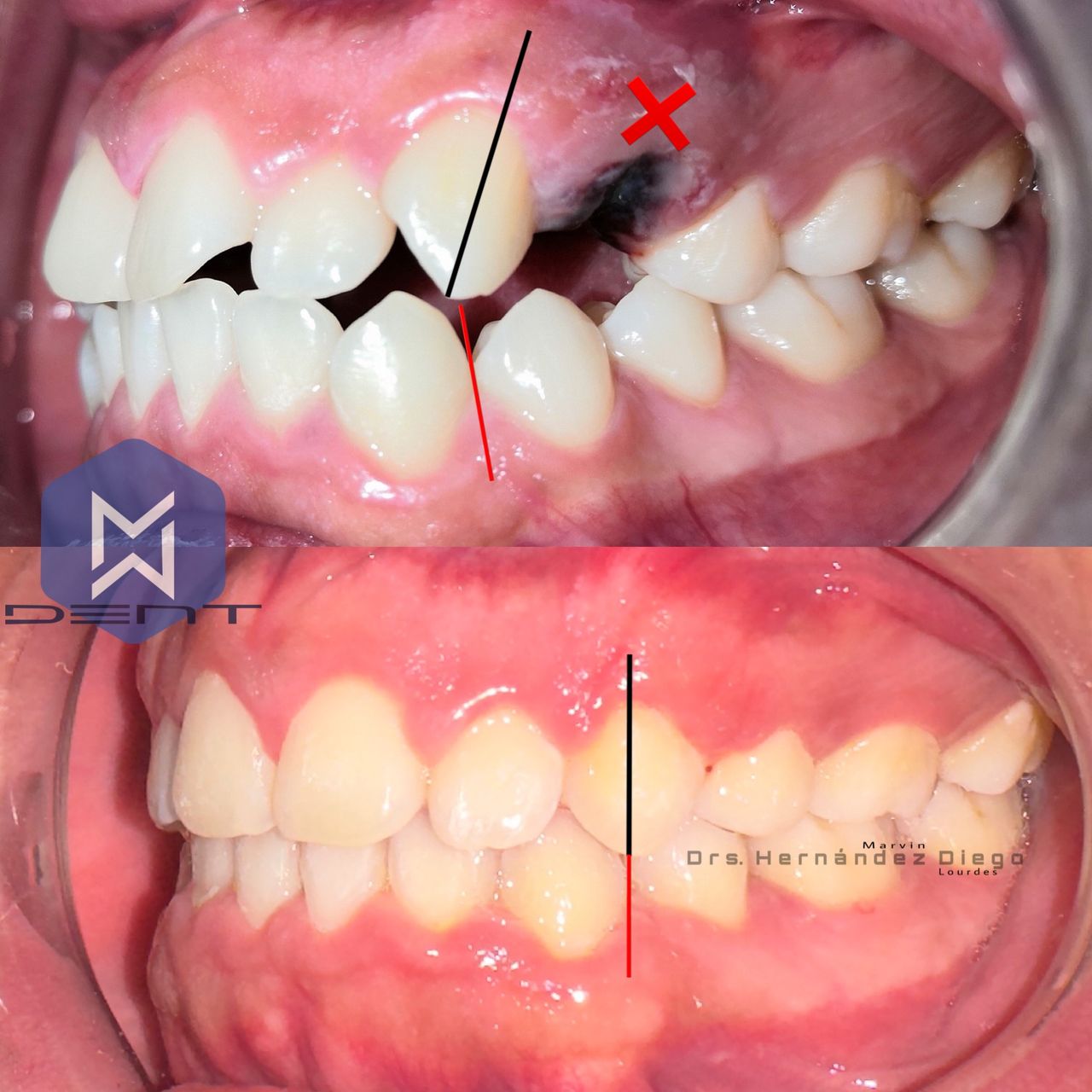 Marvin Adair Hernández Álvarez-39
