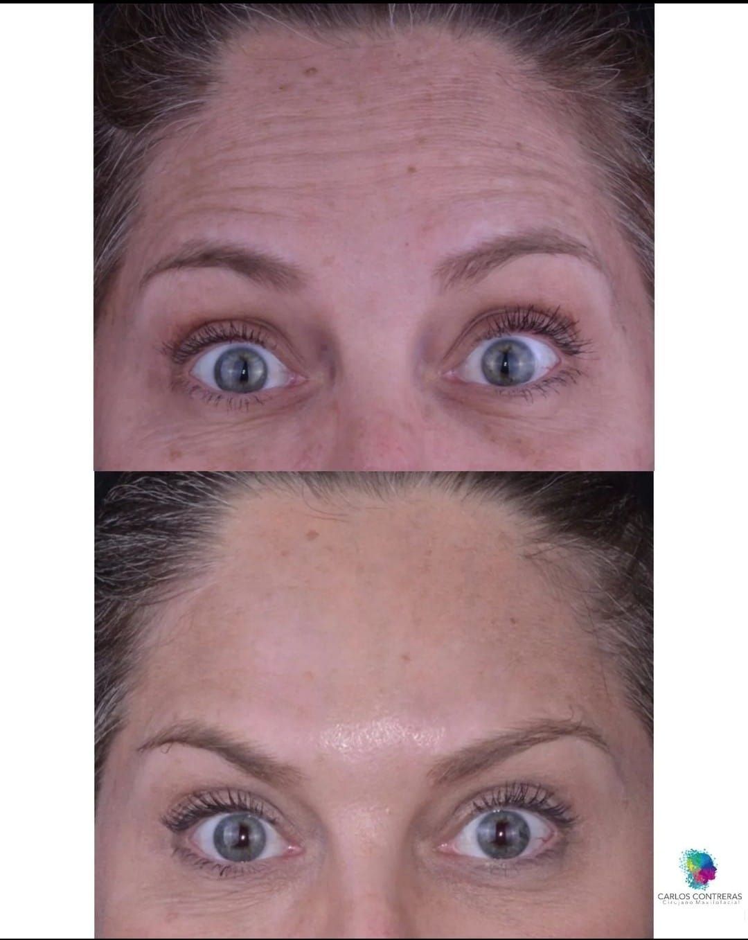 Carlos Ernesto Contreras Castellanos-29