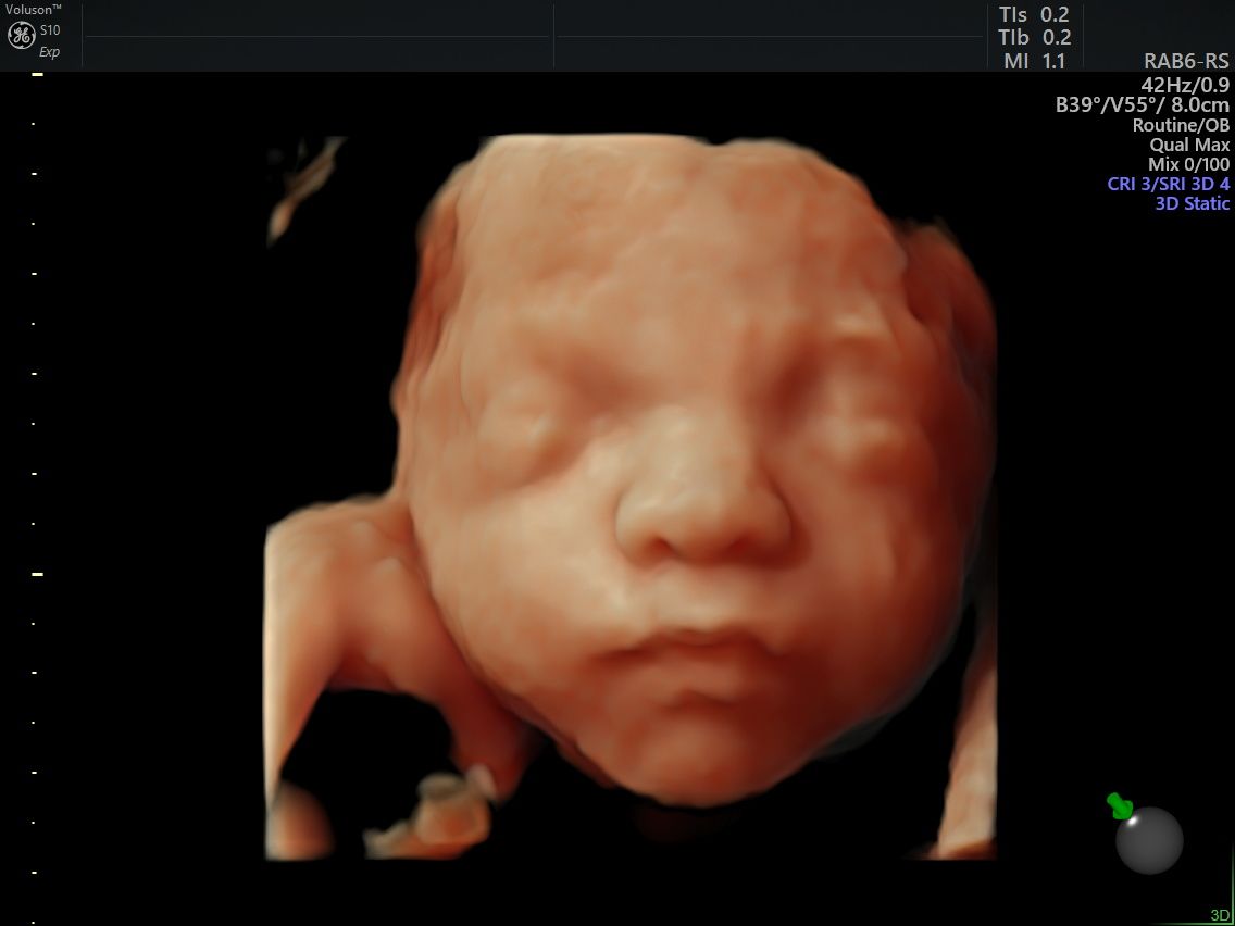 Arturo Herrera Flores-3