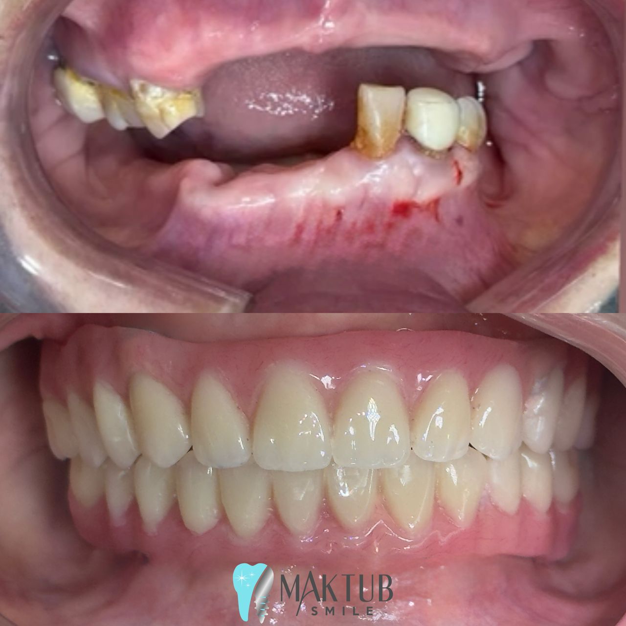 Nairoby Contreras-25