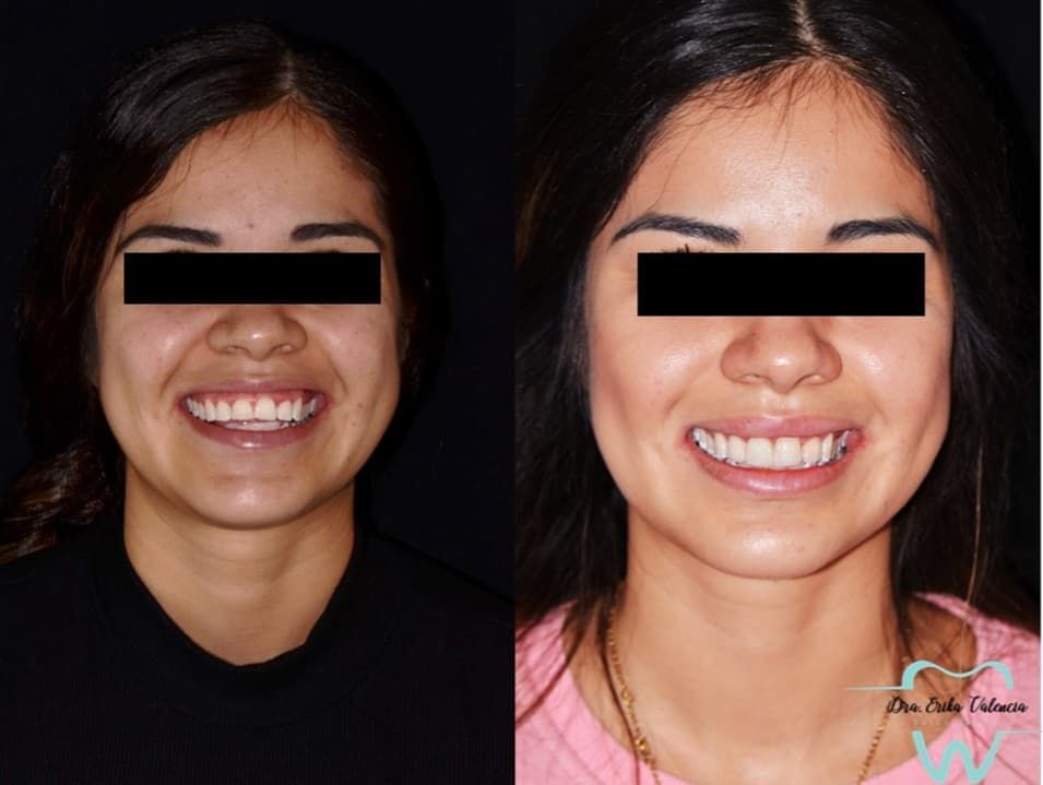 Erika Stephany Valencia Delgadillo-18