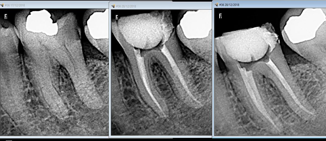 Lesli Erendira Campechano Zaragoza-14