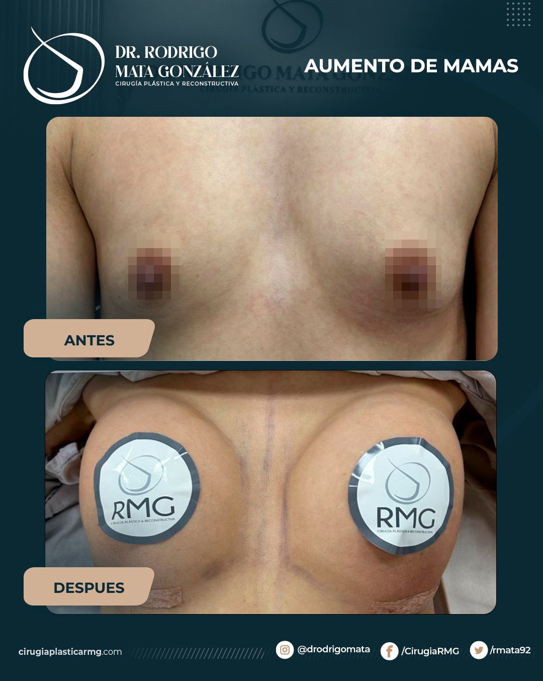 Rodrigo Mata Gonzalez-16