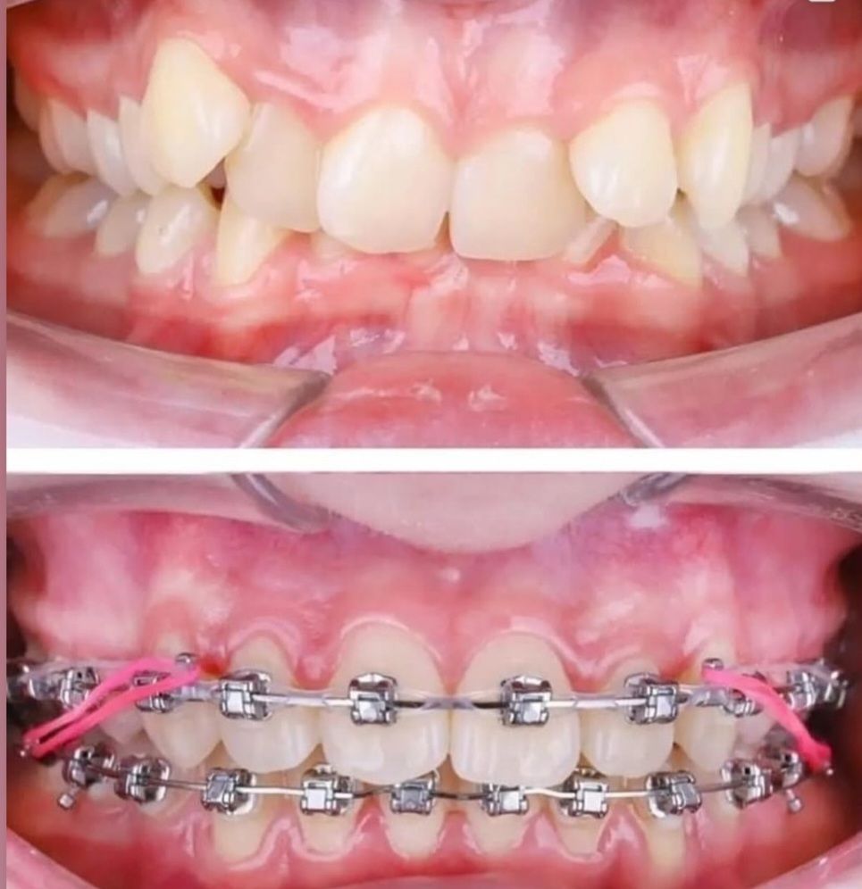 Fabiola Arcos Huesca-64