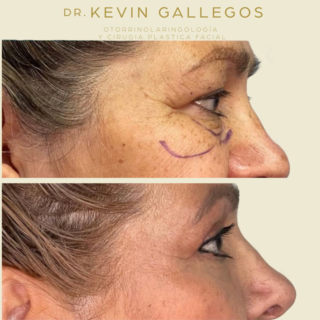 Kevin Iram Gallegos Montero-6