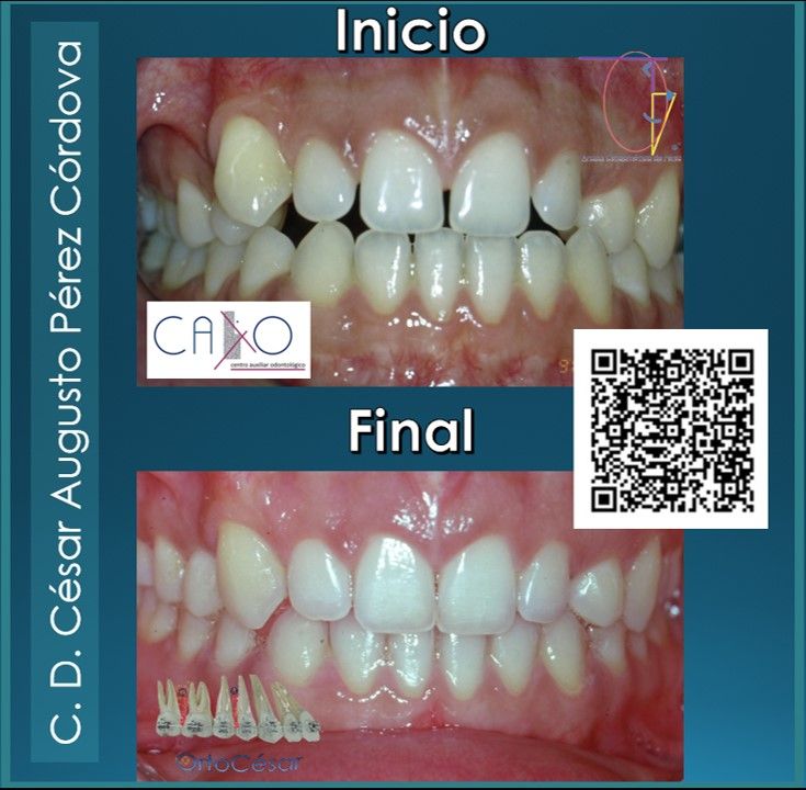 César Augusto Pérez Córdova-21